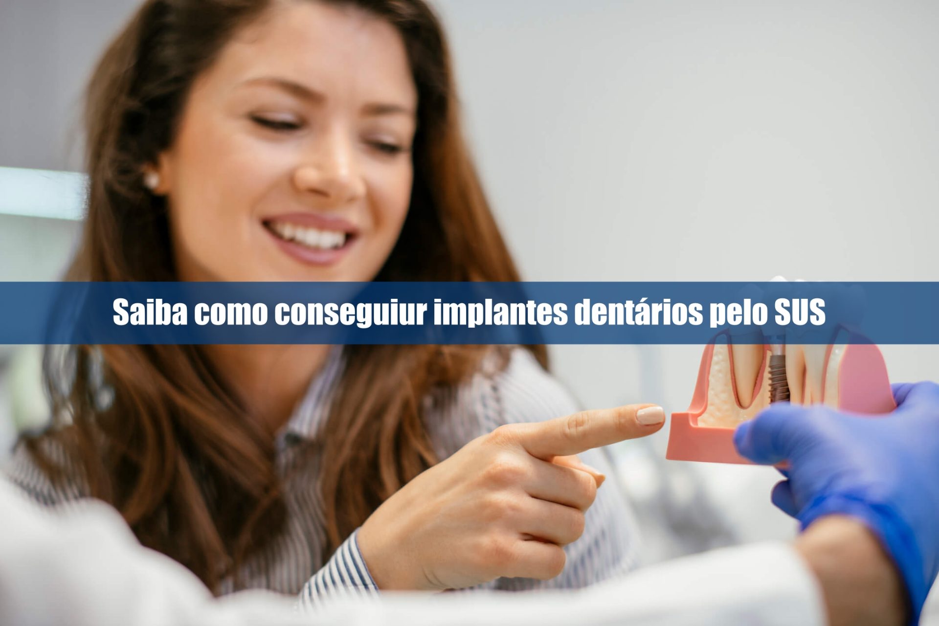 Saiba como conseguir implantes dentários pelo SUS