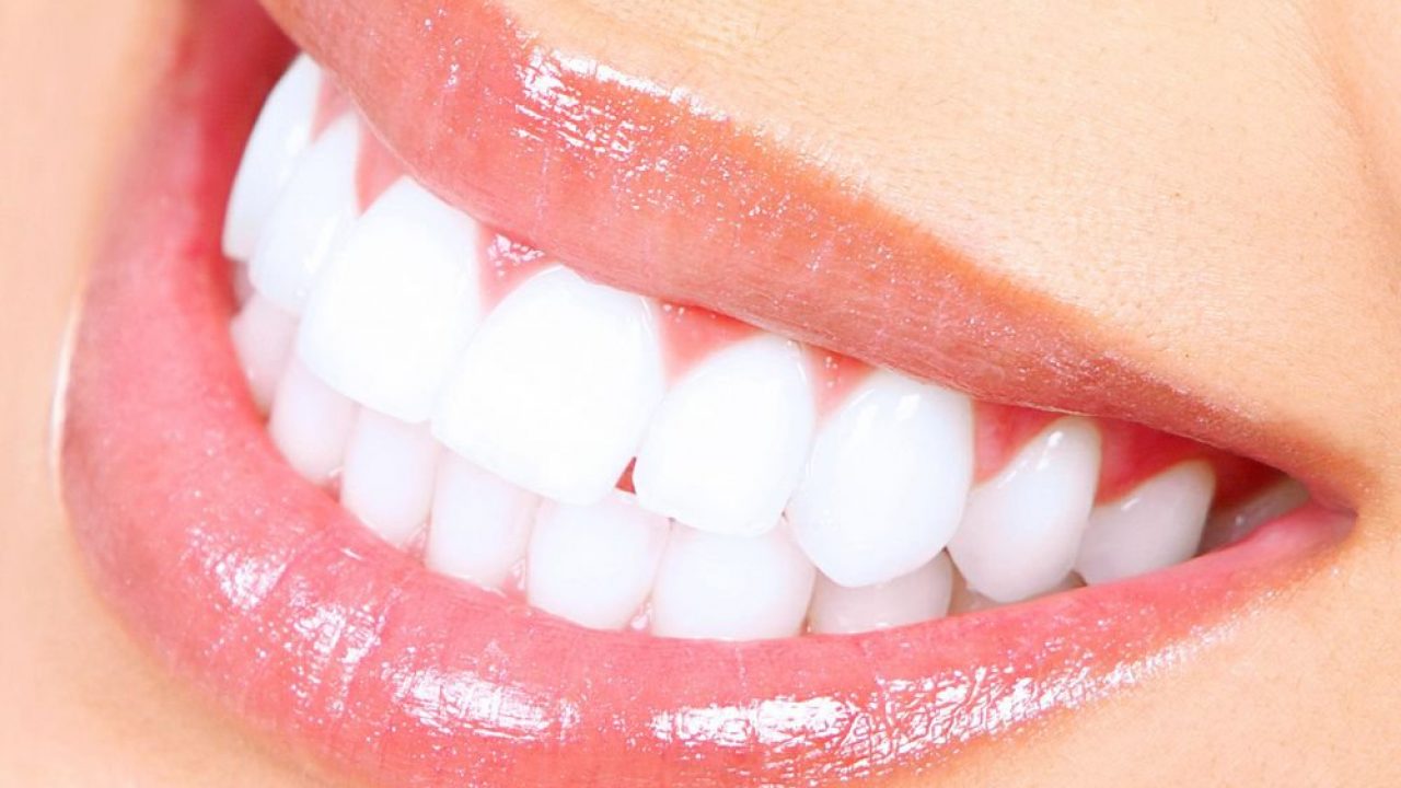 como clarear os dentes
