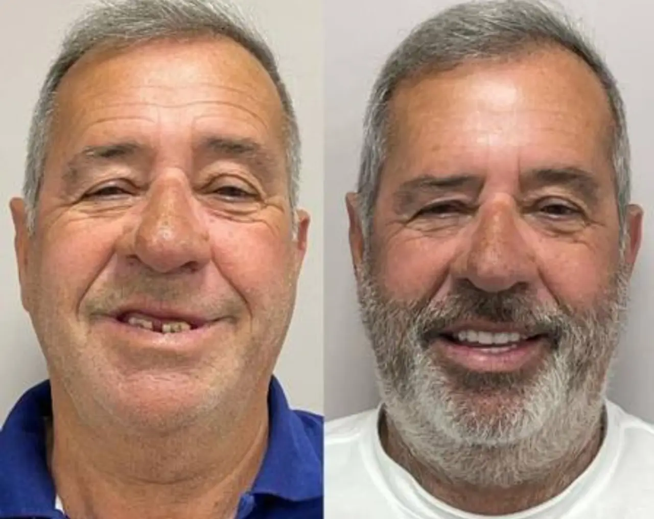 Como se inscrever no Brasil Sorridente